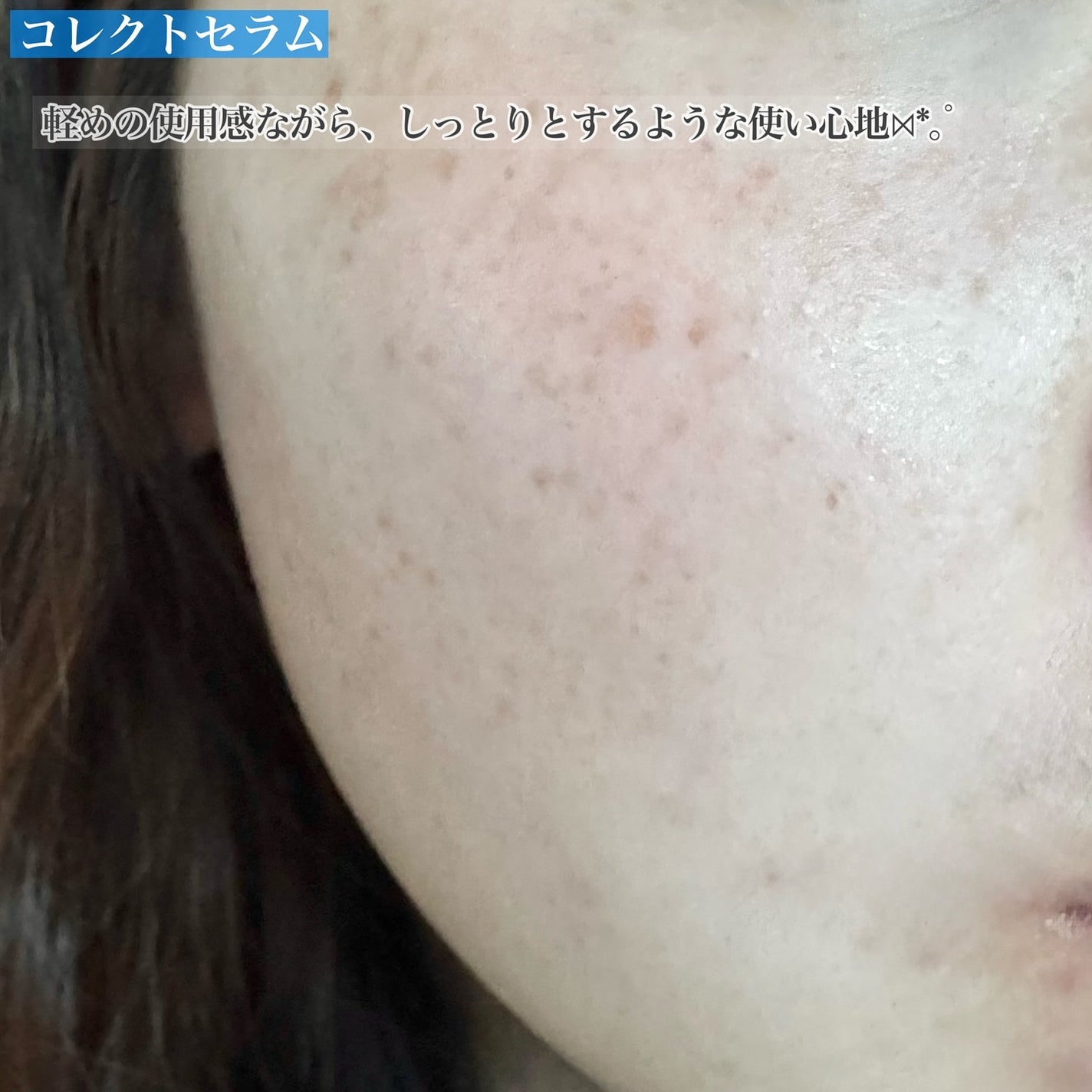 いち on LIPS 「*Snp✔︎︎︎︎コレクトセラムリアルショット30ml✔︎︎︎..」(9枚目)