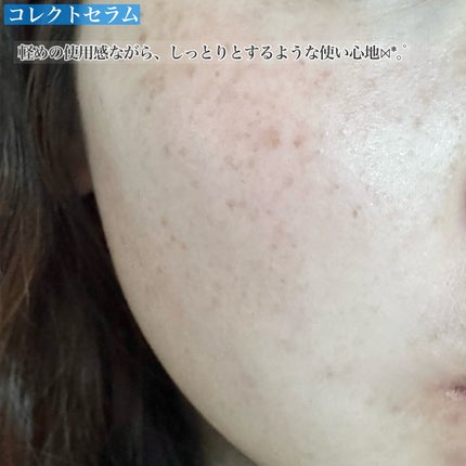 いち on LIPS 「*Snp✔︎︎︎︎コレクトセラムリアルショット30ml✔︎︎︎..」(9枚目)