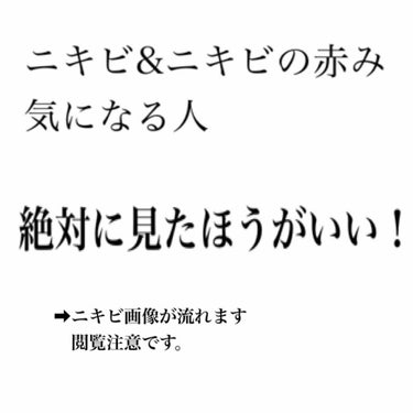 メラノCC 薬用 しみ 集中対策 美容液のクチコミ「 #ガチレビュー 
私はニキビが凄すぎました。何をしてもダメ、プロアクティブもダメ、皮膚科もダ.....」（1枚目）