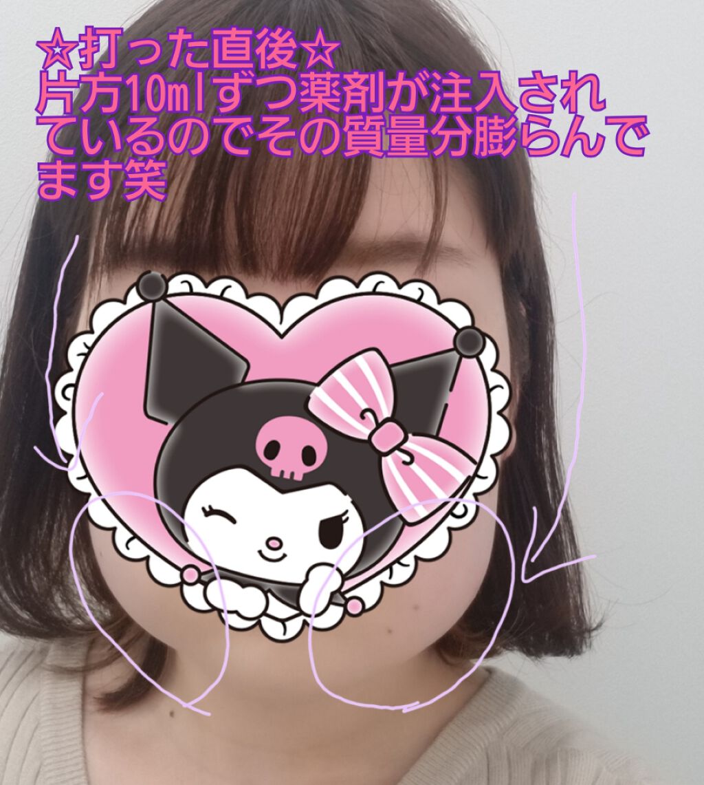 報告/その他を使ったクチコミ（2枚目）