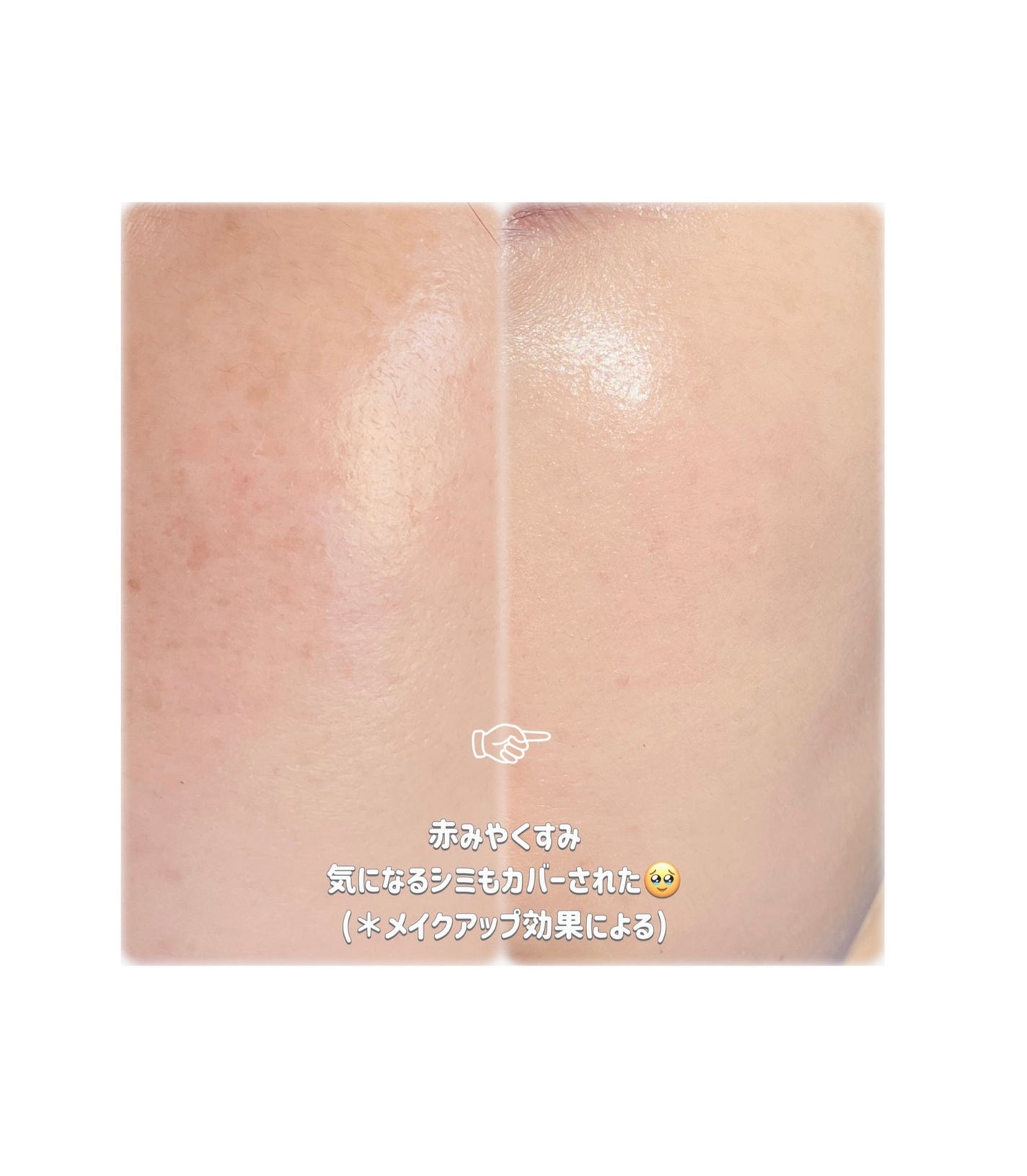 コンシールブレンダーパレット/LUNA/パレットコンシーラーを使ったクチコミ(4枚目)