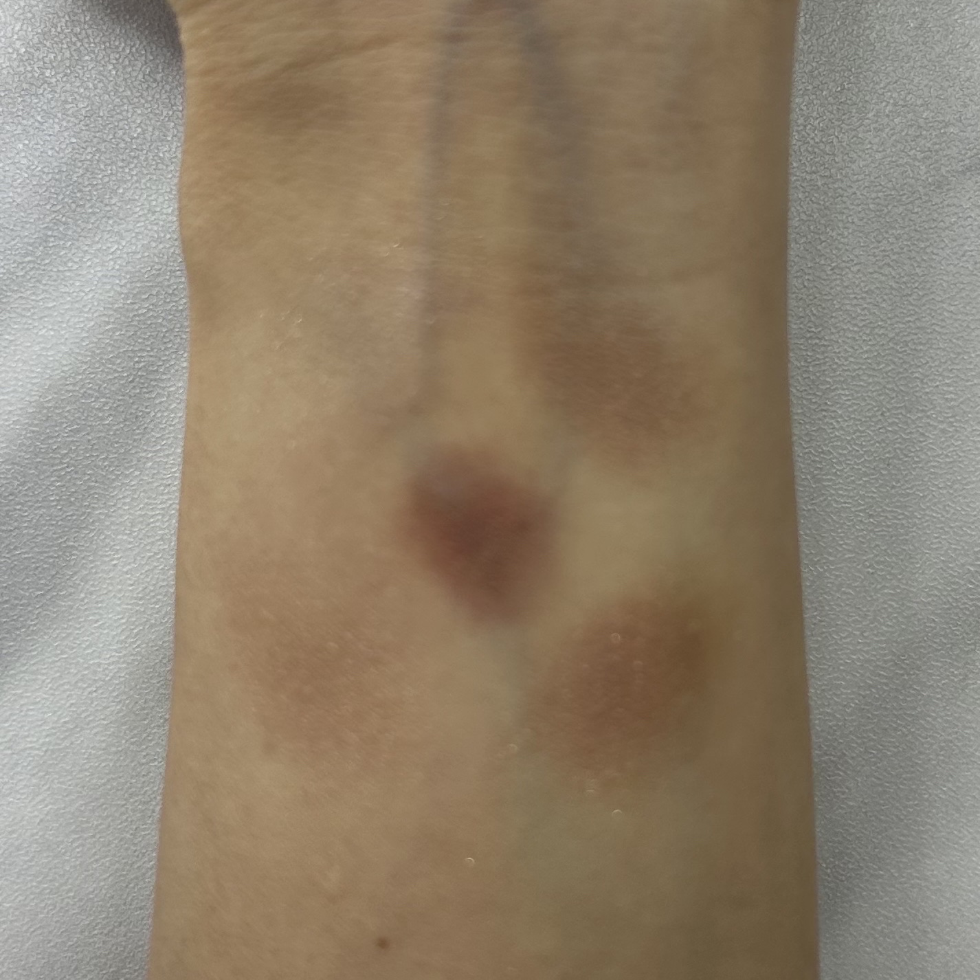 グロウフルールチークス/キャンメイク/パウダーチークを使ったクチコミ（3枚目）