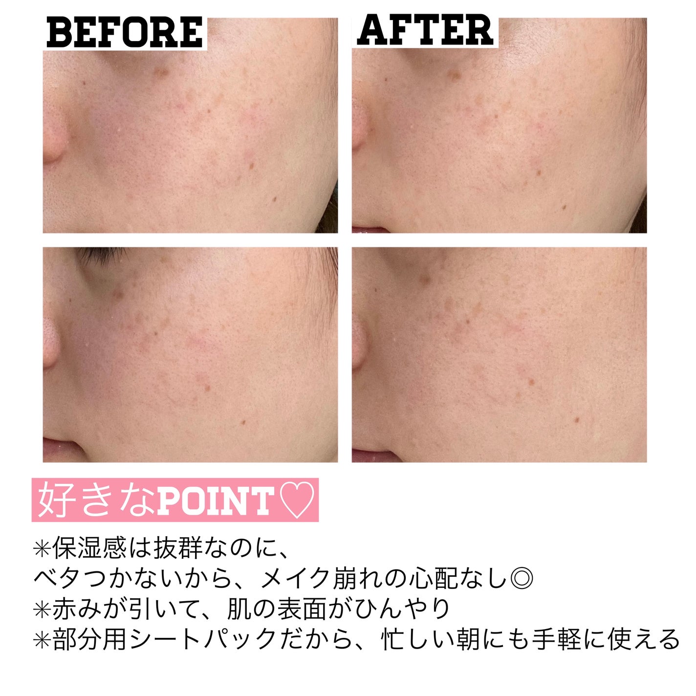 ウォンジョンヨ モイストアップレディスキンパック N/Wonjungyo/シートマスク・パックを使ったクチコミ(3枚目)