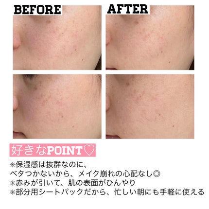 ウォンジョンヨ モイストアップレディスキンパック N/Wonjungyo/シートマスク・パックを使ったクチコミ(3枚目)