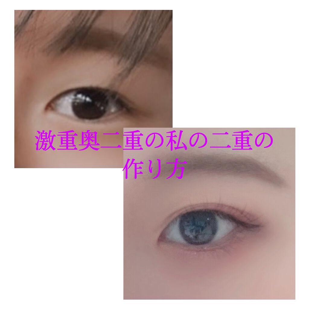 のびーるアイテープ(絆創膏タイプ、レギュラー)/DAISO/二重まぶた用アイテムを使ったクチコミ(1枚目)