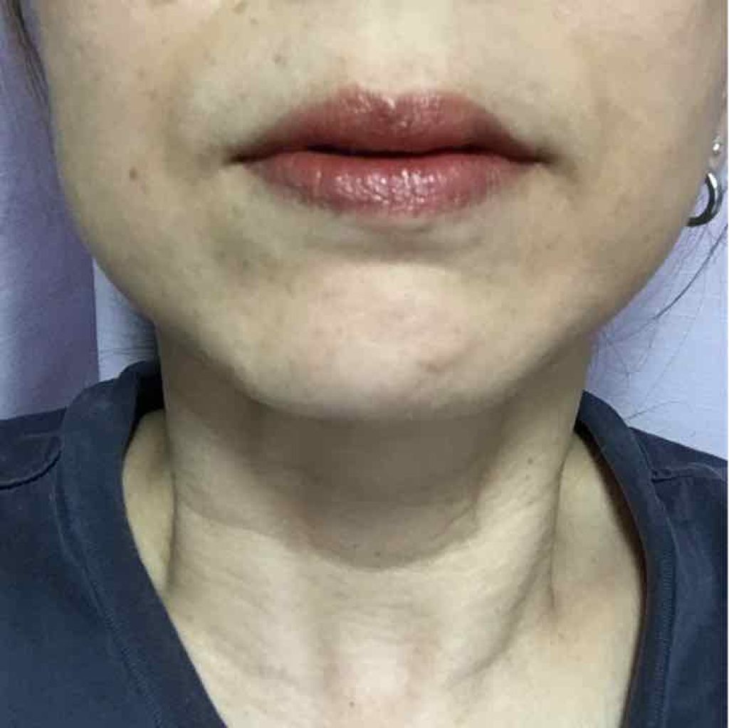 リップケア カラーUVスティック/RMK/口紅を使ったクチコミ(1枚目)