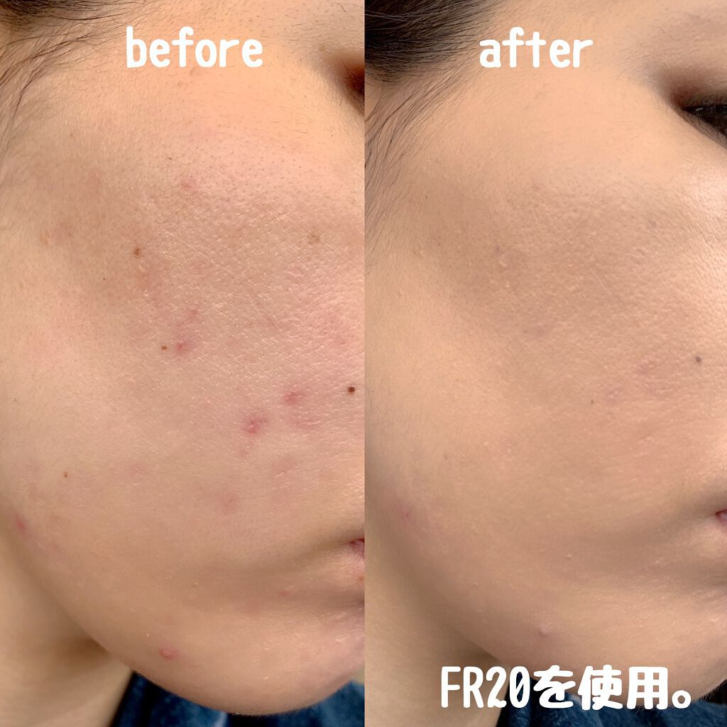 フローレス フィット/COVERMARK/クリーム・エマルジョンファンデーションを使ったクチコミ(3枚目)