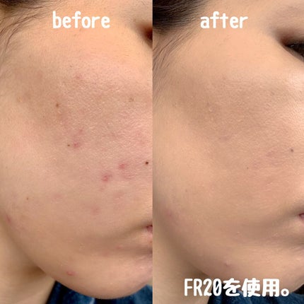 フローレス フィット/COVERMARK/クリーム・エマルジョンファンデーションを使ったクチコミ(3枚目)