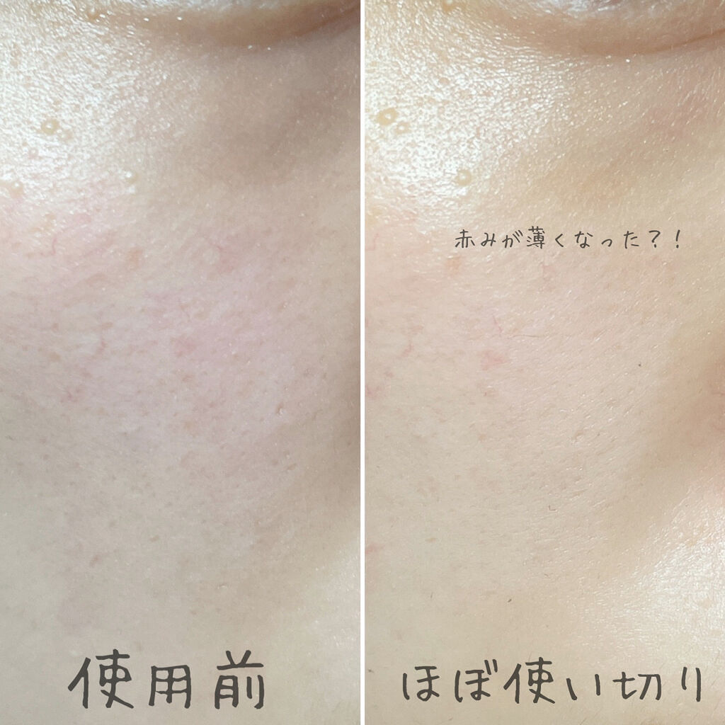 セラムショット　N/PHOEBE BEAUTY UP/美容液を使ったクチコミ（3枚目）