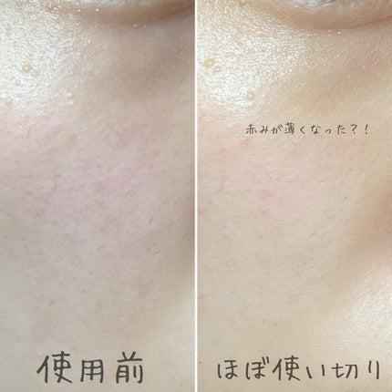 セラムショット N/PHOEBE BEAUTY UP/美容液を使ったクチコミ(3枚目)