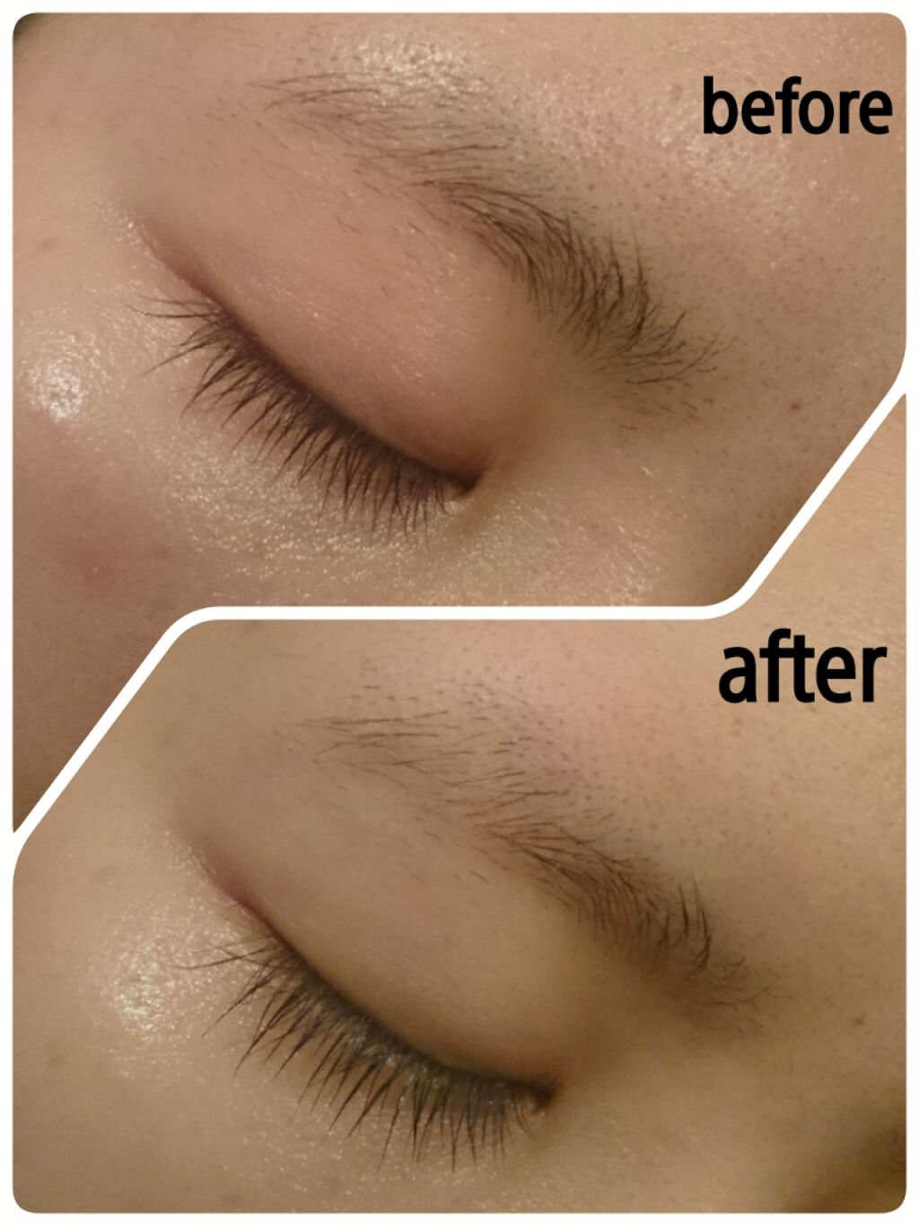 脱色クリーム スピーディー/エピラット/ムダ毛ケアを使ったクチコミ（2枚目）