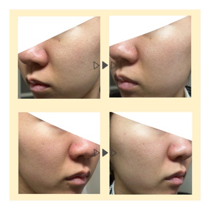 V エッセンス/unlabel/美容液を使ったクチコミ(3枚目)