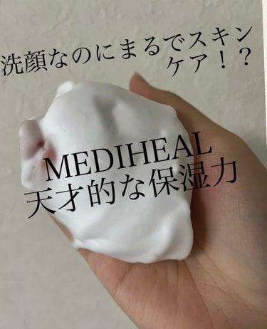 【MEDIHEAL N.M.F アクアリング クレンジングフォーム JEX】

※このフォームは泡状ではなくチューブタイプです。
写真（普段使いの際）は100均の購入品で泡状にしています🙇‍♀️

洗顔してタオルドライ後、洗顔前より肌が乾燥してしまうなんてことはありませんか？💭

そんな方にオススメなのがN.M.F アクアリング クレンジングフォーム JEX！

特にあわだてて使用すると、効果倍増⤴︎
ヒアルロン酸配合で。洗顔してタオルドライした後も、肌が保湿されてしっとりしてるの✨

ぜひ手に取ってみてね☺︎

フォロー、いいね、コメントお待ちしています♪

#正直レビュー  #揺らぎ肌ケア #MEDIHEAL#N.M.F アクアリング クレンジングフォーム JEX#洗顔_おすすめ #せんがん
の画像 その0