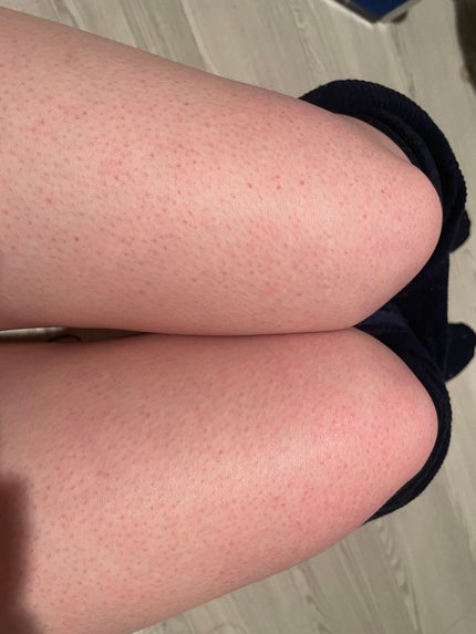ヴィート ピュアバスタイム除毛クリーム 敏感肌用/Veet/除毛クリームを使ったクチコミ(2枚目)