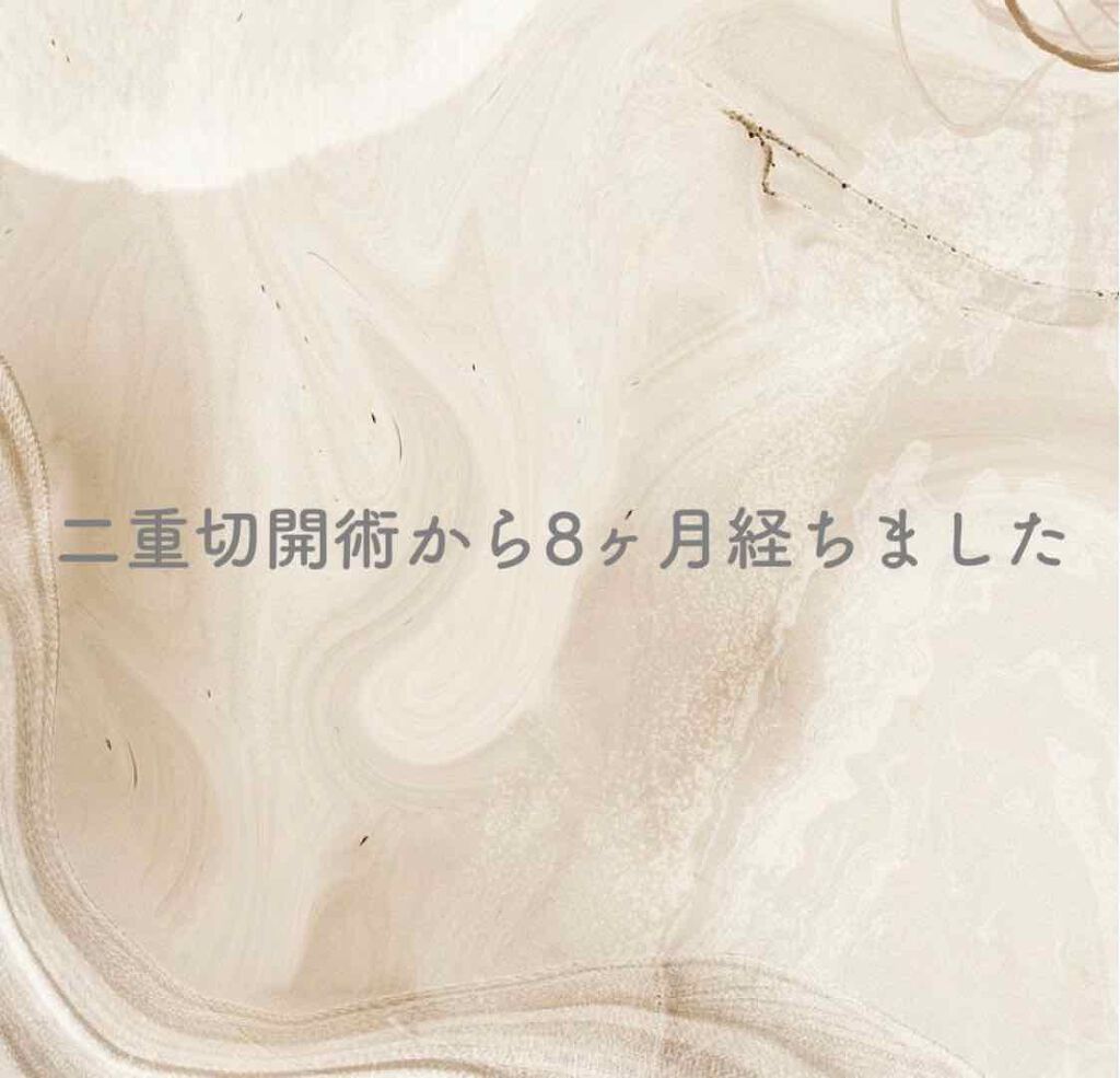 二重整形/その他を使ったクチコミ（1枚目）