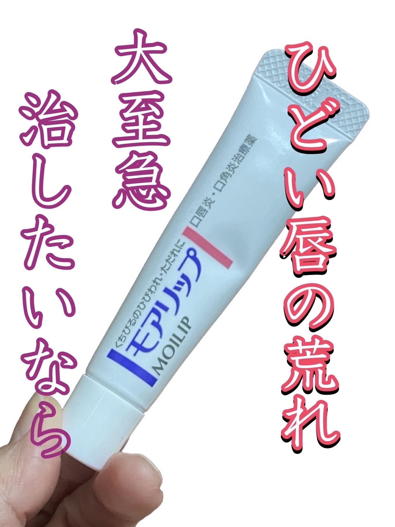 モアリップ N (医薬品)/資生堂薬品/その他を使ったクチコミ（1枚目）