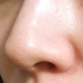 【アラフォーの毛穴ケア】たるみや開き毛穴、いちご鼻の改善方法《プチプラのおすすめアイテムも！》のサムネイル