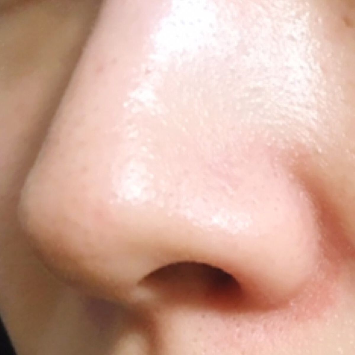 【アラフォーの毛穴ケア】たるみや開き毛穴、いちご鼻の改善方法《プチプラのおすすめアイテムも!》のサムネイル