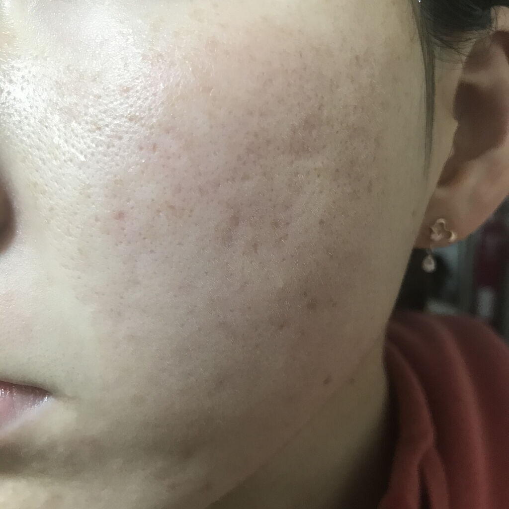 Amino Acid+B5/The Ordinary/美容液を使ったクチコミ（2枚目）