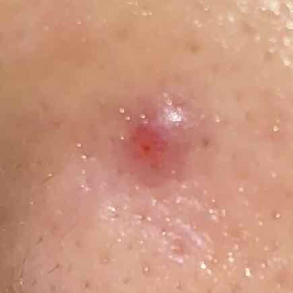 ジェルクリーム/ルナメアAC/フェイスクリームを使ったクチコミ（3枚目）