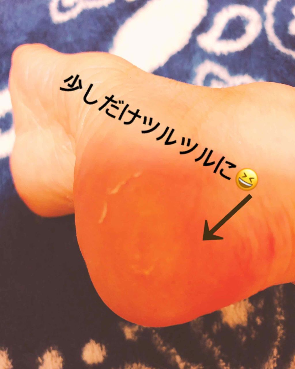 ニベアクリーム/ニベア/ボディクリームを使ったクチコミ(2枚目)