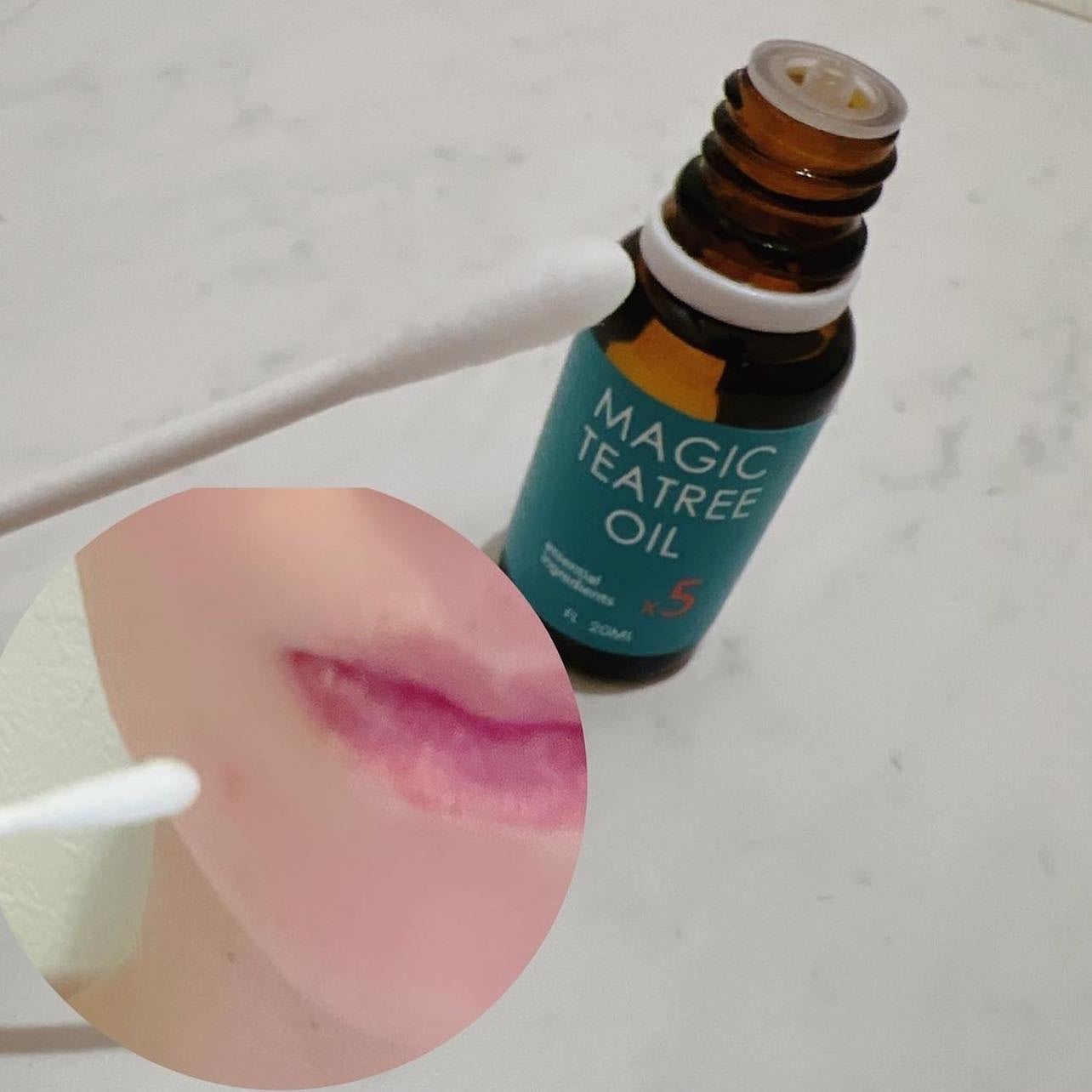 マジックトラブル洗顔/ブラン/洗顔フォームを使ったクチコミ(5枚目)