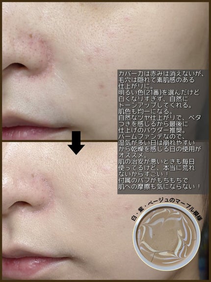 ダブル セラム バーム ファンデーション/Dr.Althea/クリーム・エマルジョンファンデーションを使ったクチコミ(2枚目)