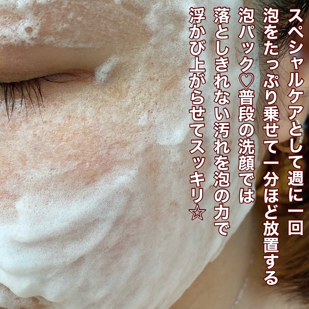 泡ミツ洗顔/BISVEIL/泡洗顔を使ったクチコミ(6枚目)