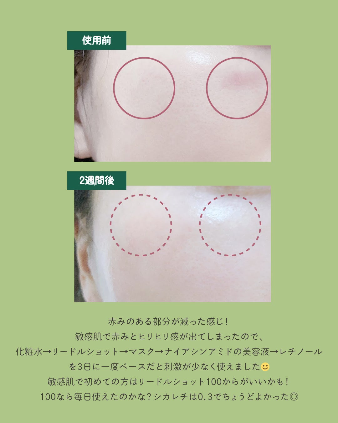 CICA デイリースージングマスク/VT/シートマスク・パックを使ったクチコミ(5枚目)