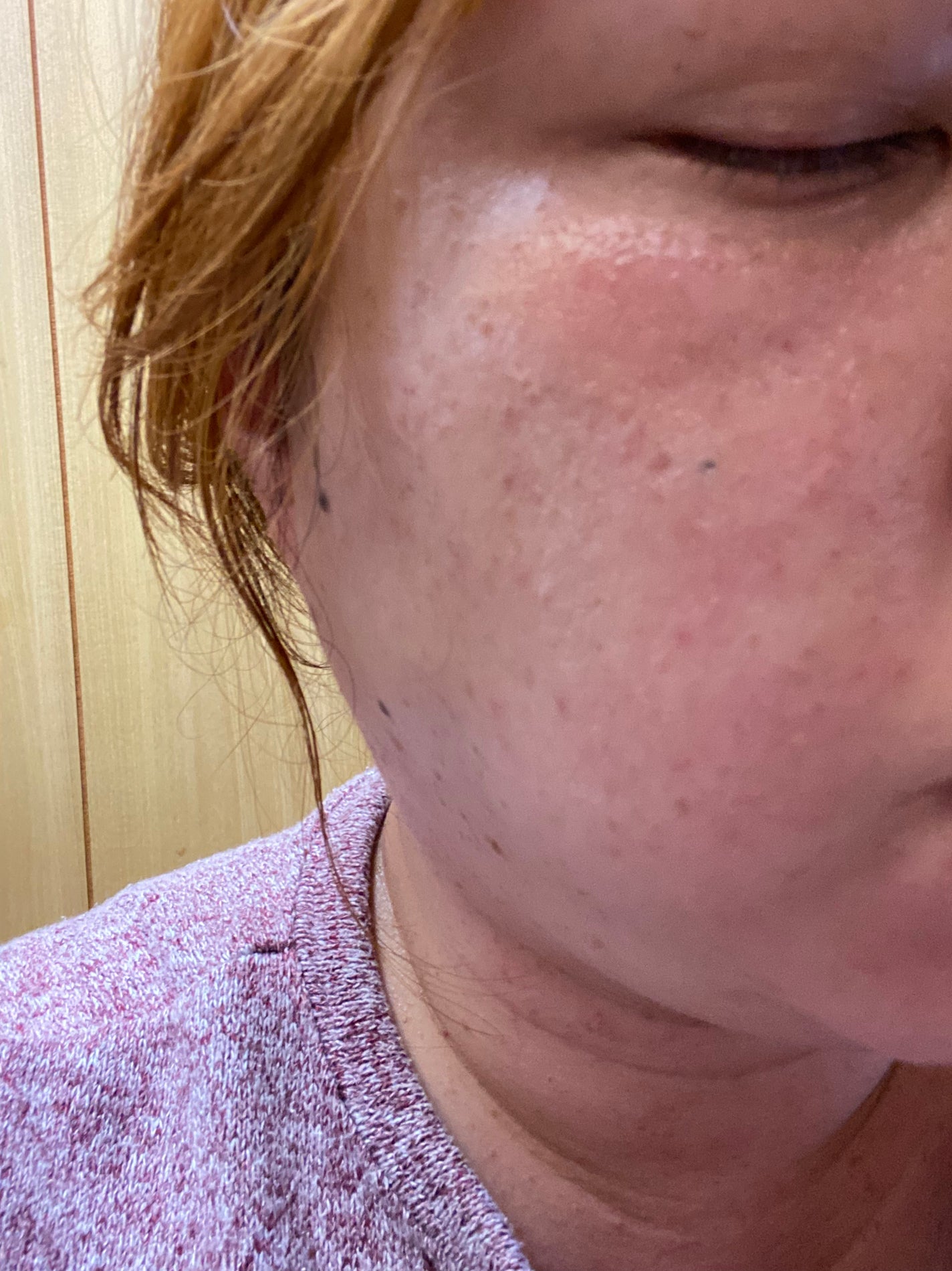 アレルバリア エッセンス N/d プログラム/美容液を使ったクチコミ(3枚目)