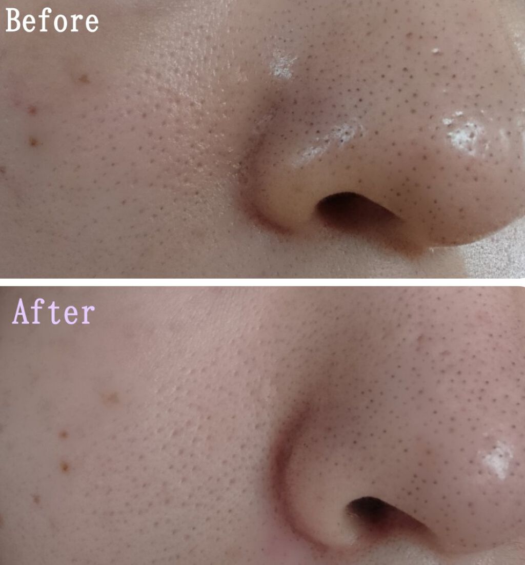 お1人様1点限り】 ととのうみすと cerkafor.com