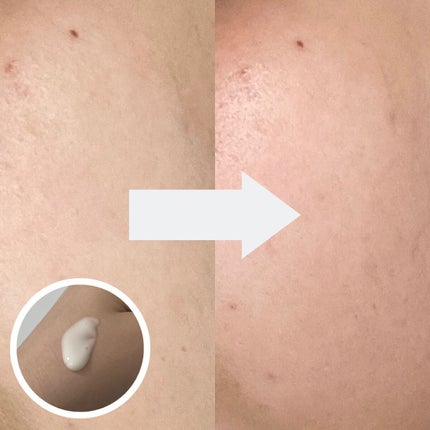 ユース ラディアンス ビタチノール セラム/primera/美容液を使ったクチコミ(4枚目)