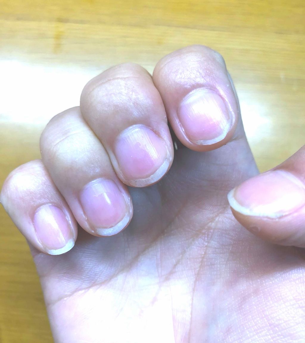 AC キューティクルオイル/AC MAKEUP/ネイルオイル・トリートメントを使ったクチコミ（2枚目）