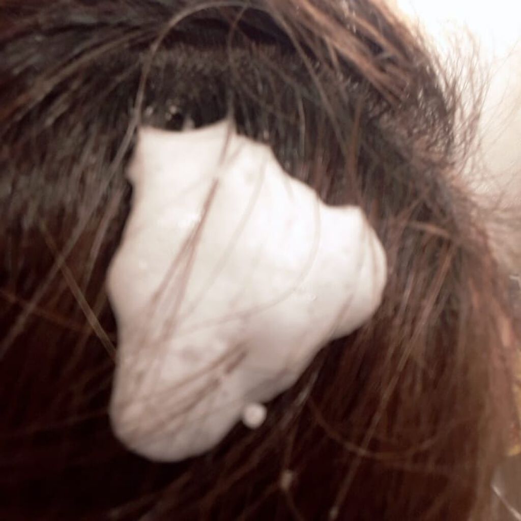 薬用スパークリング スカルプケア/ドクターベルツ/頭皮ローションを使ったクチコミ（3枚目）