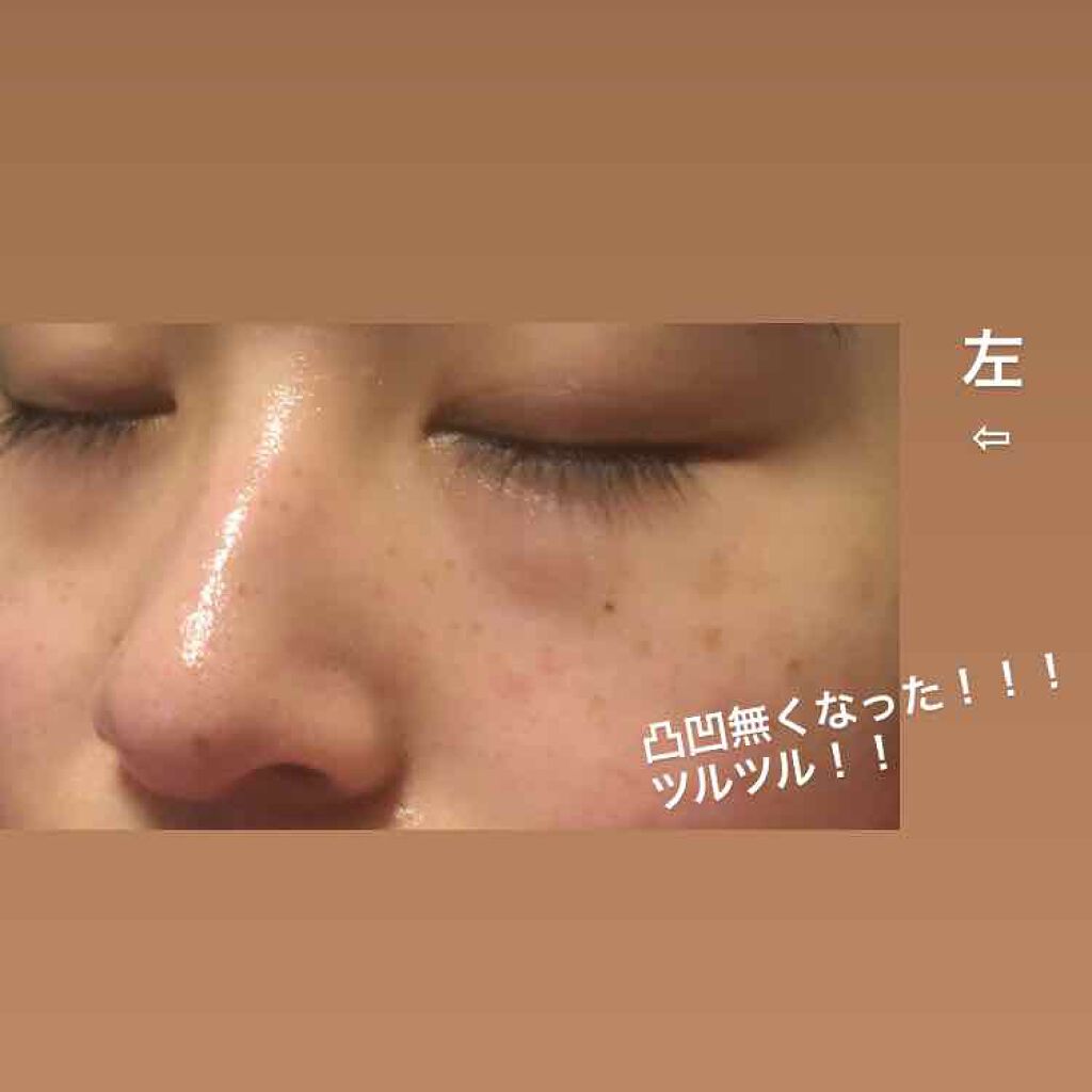 サンホワイトP-1/サンホワイト/ボディクリームを使ったクチコミ（3枚目）