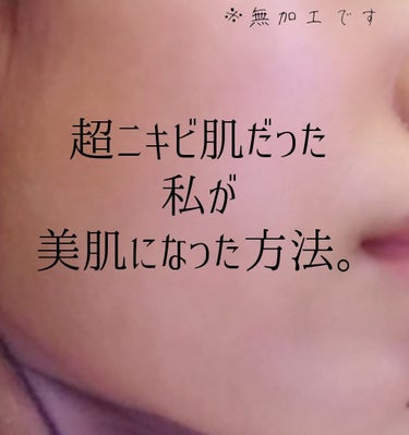 無印良品 導入化粧液のクチコミ「ご覧頂きありがとうございます🙇💕
.*･ﾟ　.ﾟ･*..*･ﾟ　.ﾟ･*..*･ﾟ　.ﾟ･*......」（1枚目）