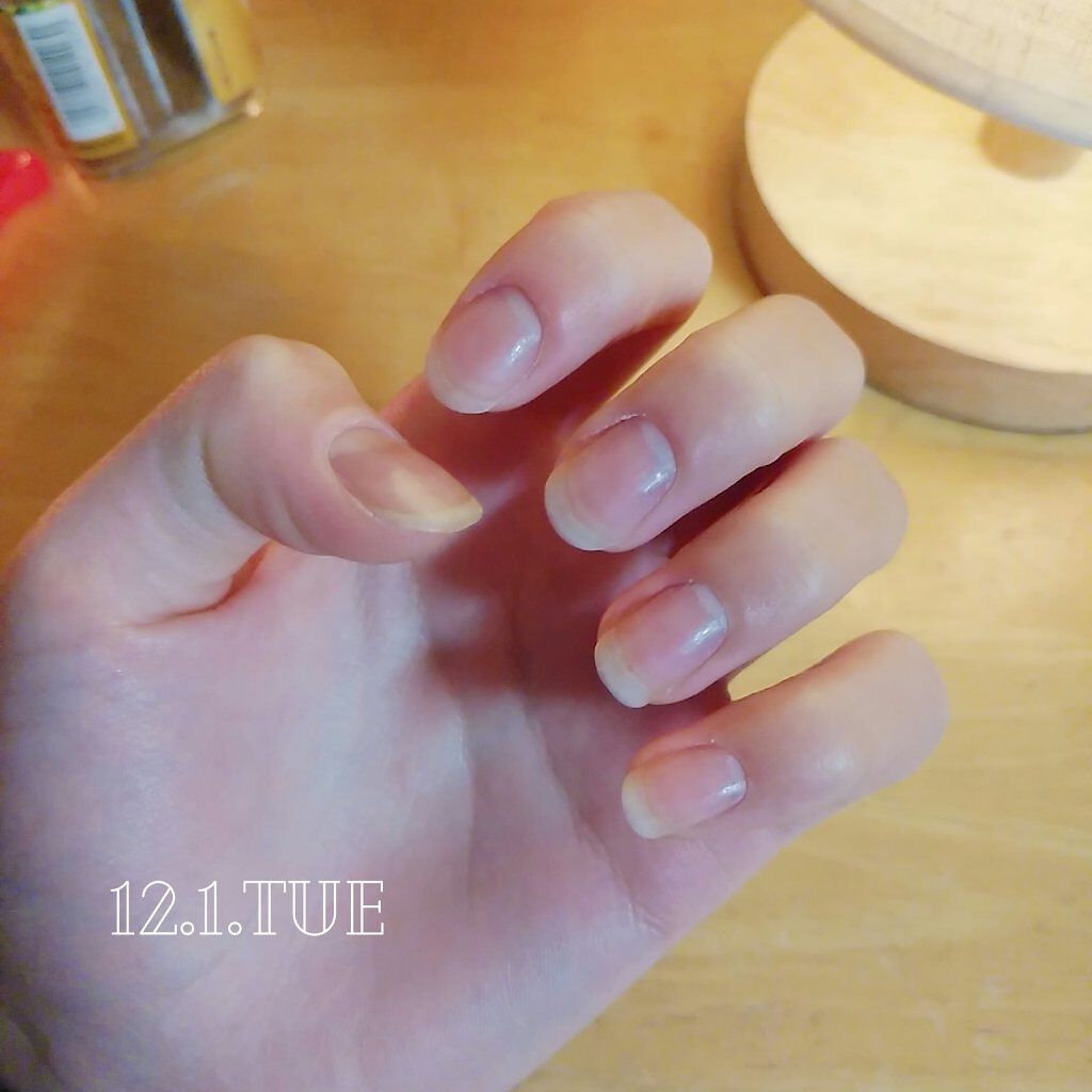 エテュセ クイックケアコート/ettusais/ネイルオイル・トリートメントを使ったクチコミ（2枚目）