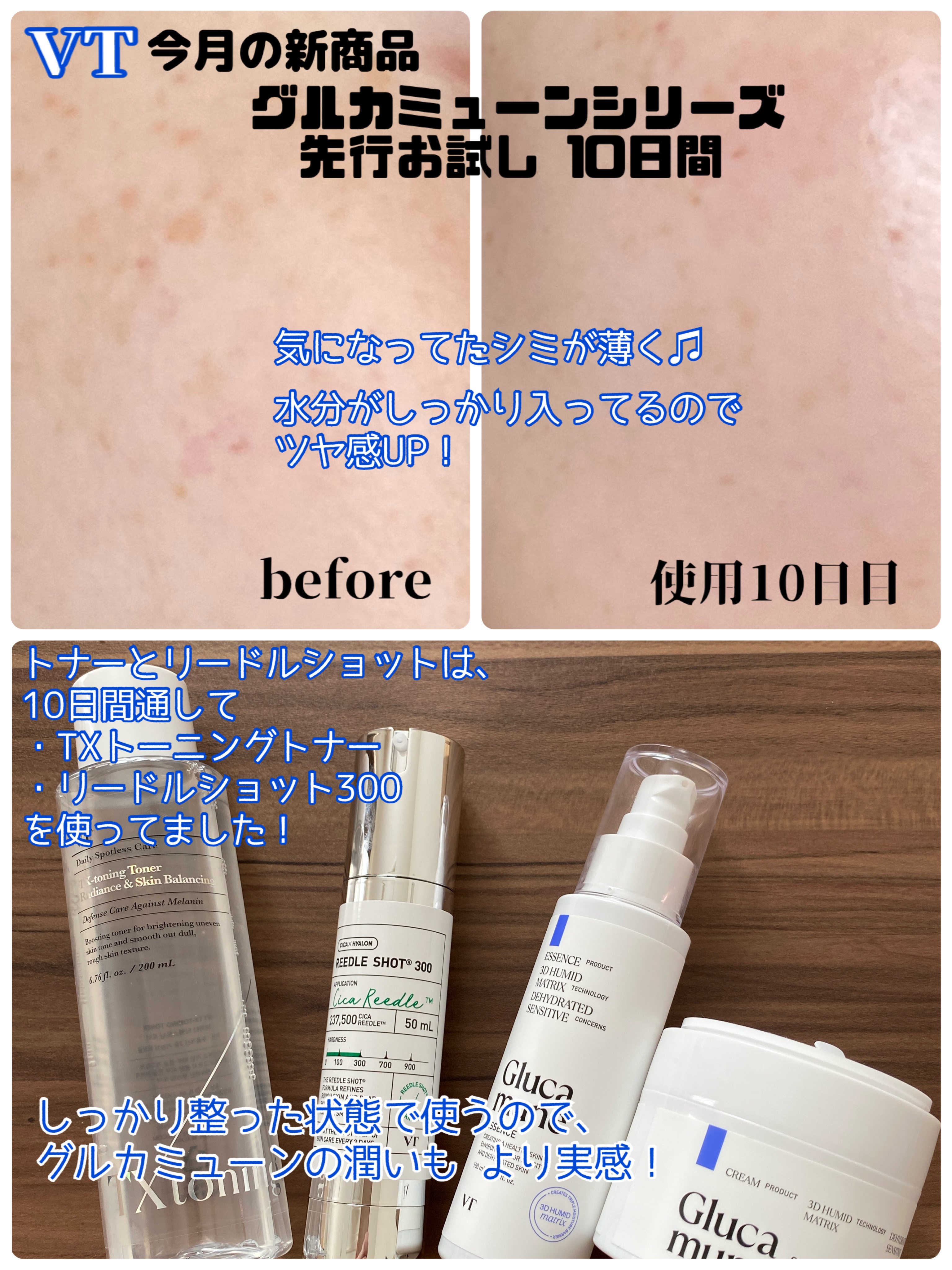 リードルショット300/VT/美容液を使ったクチコミ（1枚目）