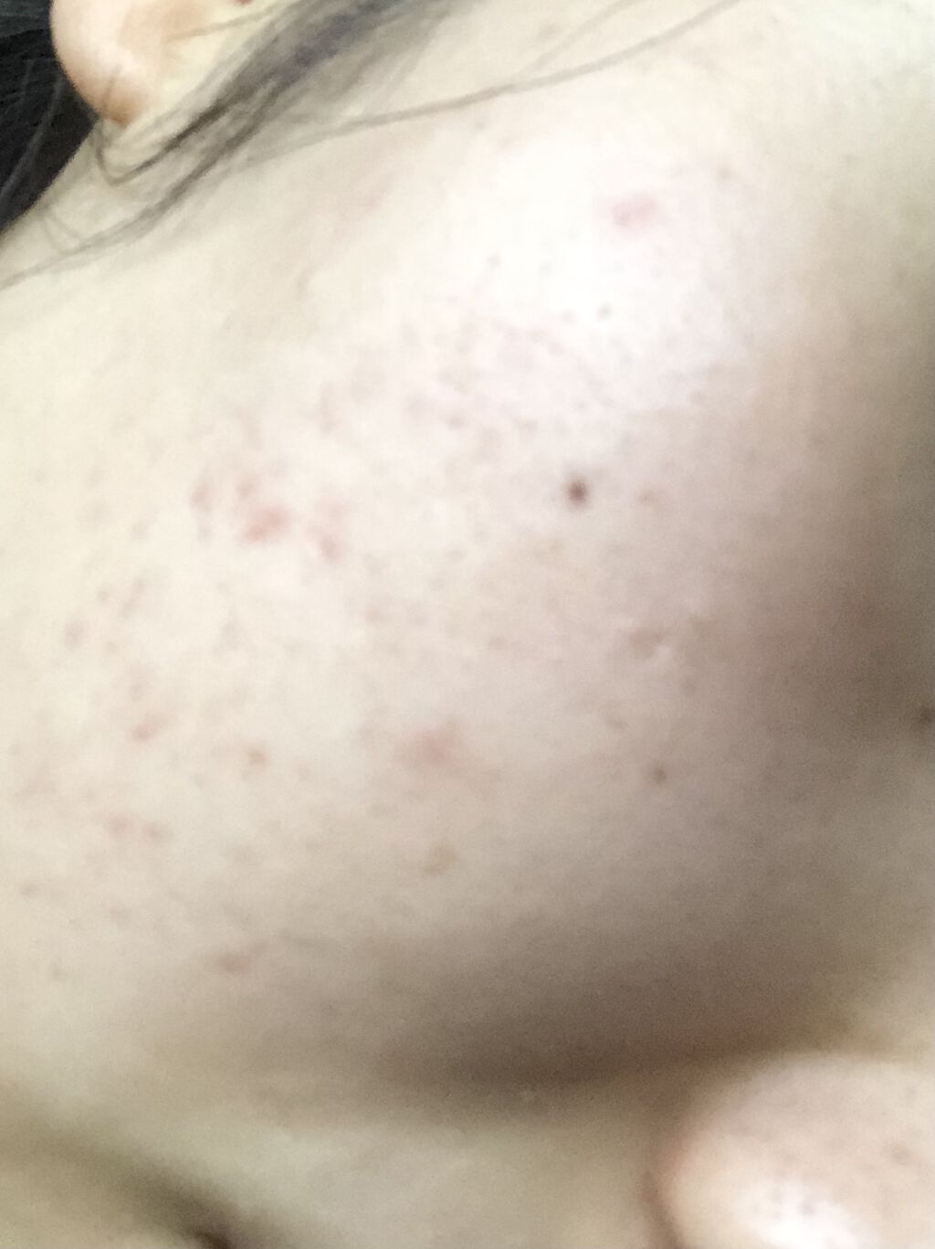 イハダ 薬用バーム【医薬部外品】/IHADA/フェイスバームを使ったクチコミ（3枚目）