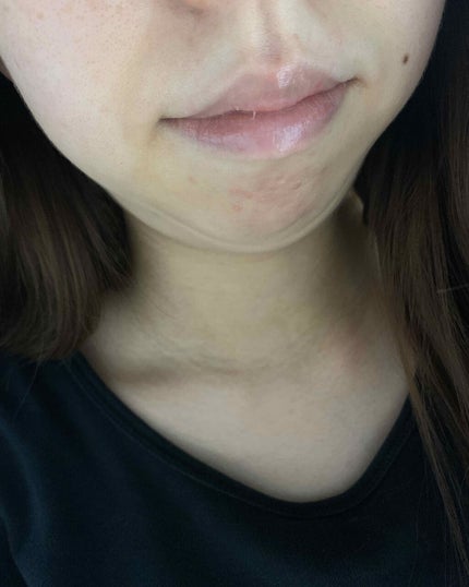 リップトリートメントベース/アテニア/リップクリームを使ったクチコミ(4枚目)