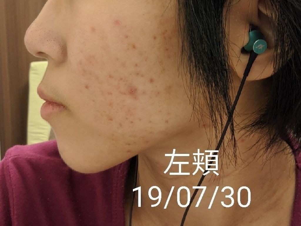 お肌断食水ローション/オリエン/ミスト状化粧水を使ったクチコミ(4枚目)