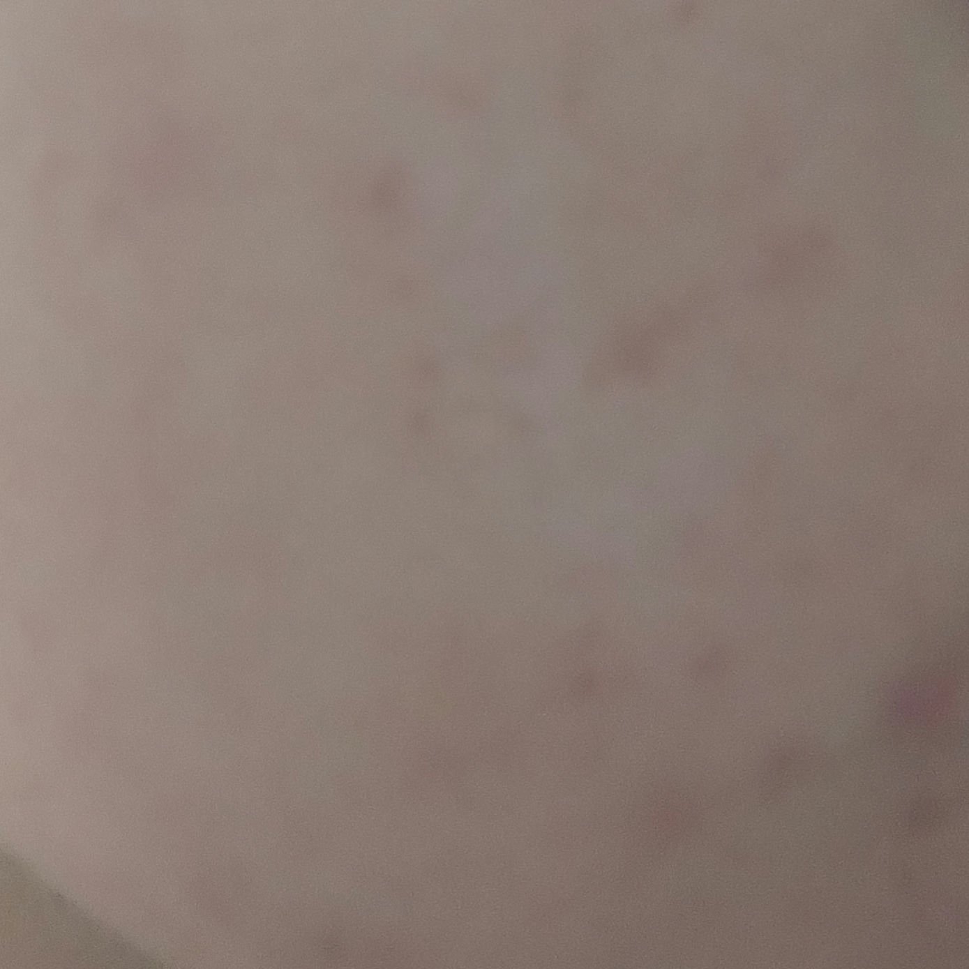 コープ ミルクローションのクチコミ「9/10
4回目
右頬
加工してないのですが部屋の照明で前よりも白っぽく見えますが変わってませ.....」（2枚目）