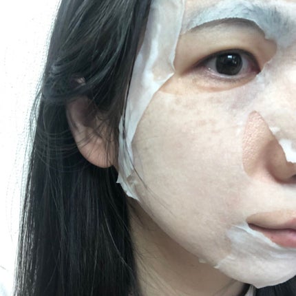 ごめんね素肌 キニナルマスク/クリアターン/シートマスク・パックを使ったクチコミ(5枚目)