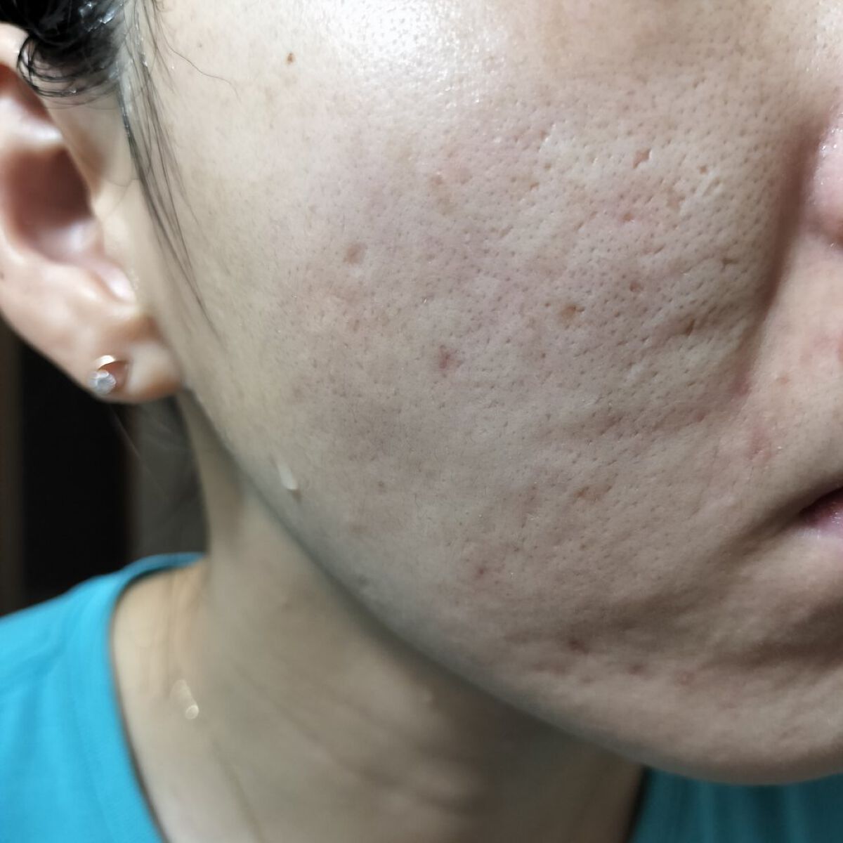 vitamin c suspension 30% in silicone/The Ordinary/美容液を使ったクチコミ（1枚目）