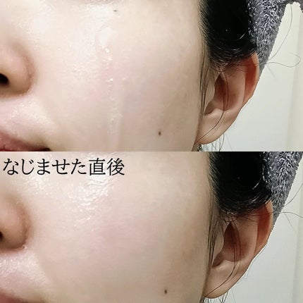 TXトーニングエッセンス2000/VT/美容液を使ったクチコミ(5枚目)