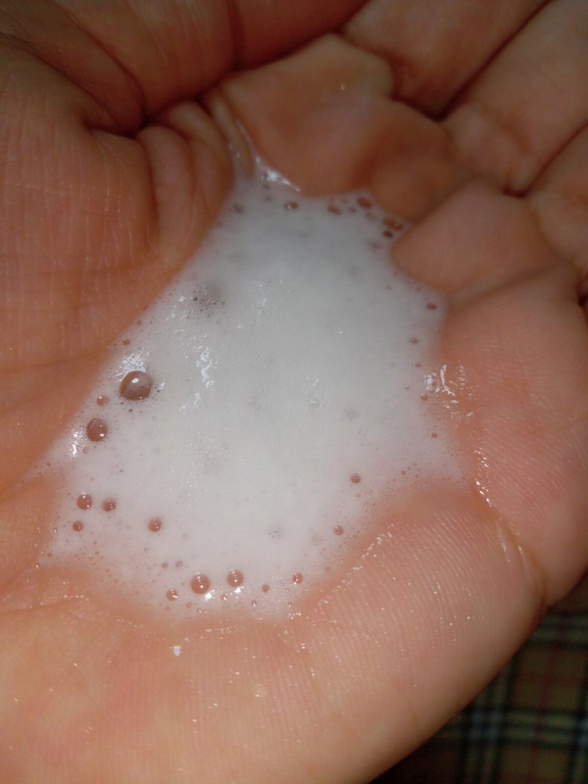 フェルゼアプレミアム 薬用泡の化粧水/フェルゼア/化粧水を使ったクチコミ（2枚目）