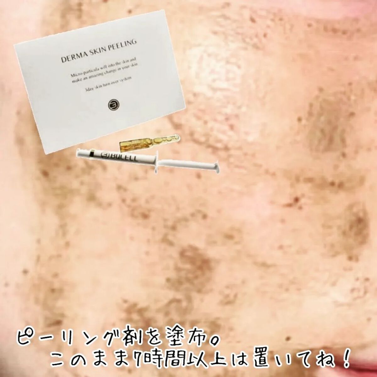 ダーマスキンピーリング/BQCELL/その他キットセットを使ったクチコミ（3枚目）