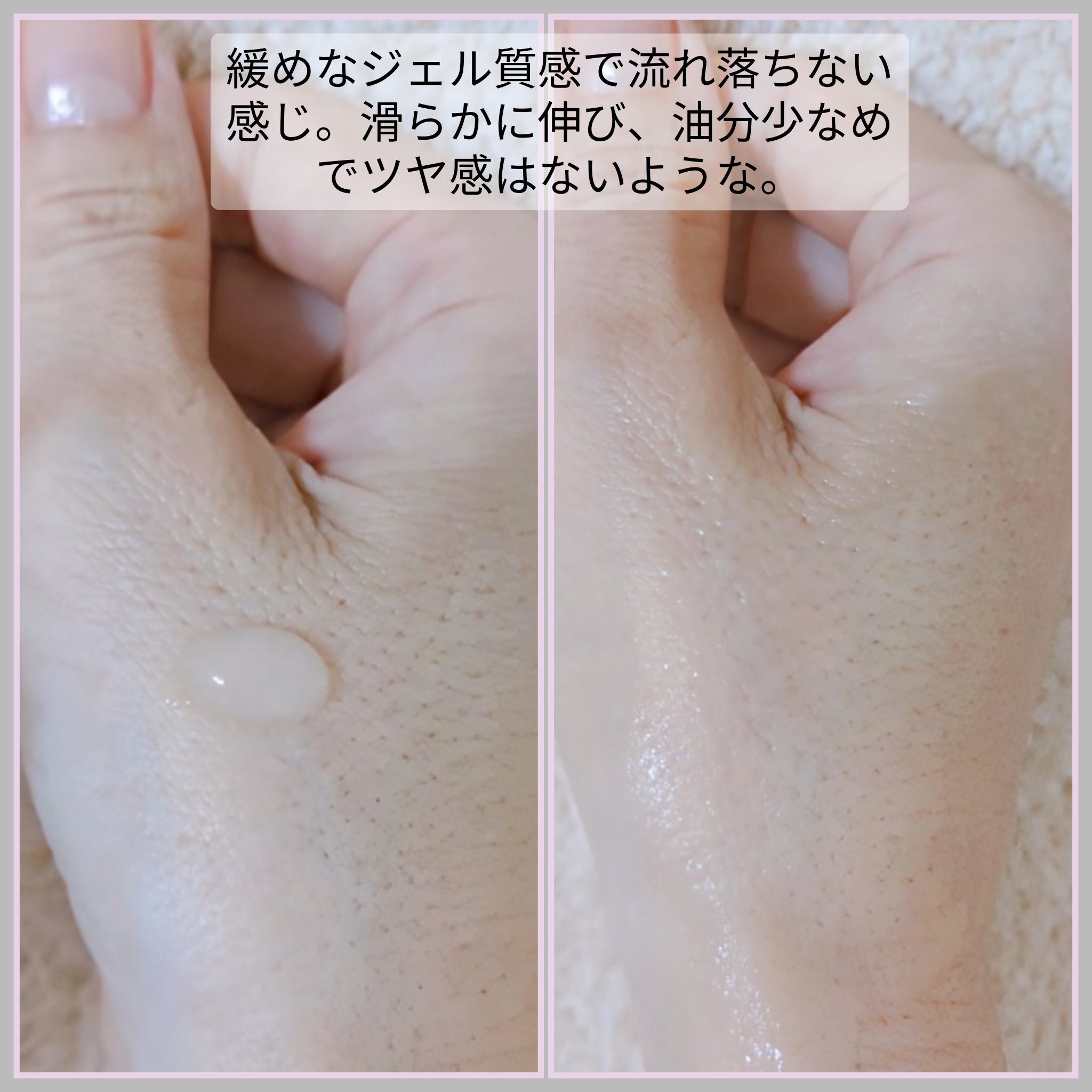 NDSポイントショット2000アンプル/ISOI/美容液を使ったクチコミ（3枚目）