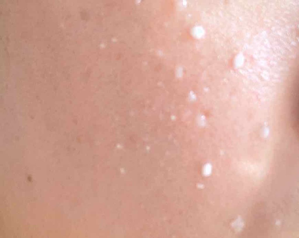 薬用クリアマスクP(美白ピーリングジェル)/DAISO/ピーリングを使ったクチコミ(3枚目)