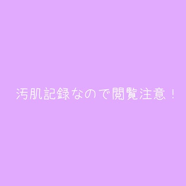 オルビスユー ジェルモイスチャライザー/オルビス/フェイスクリームを使ったクチコミ（2枚目）